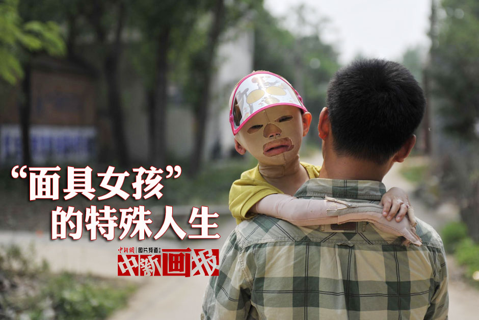 Cao Fei, held by his father in Xiping county, Henan province. (Photo/Chinanews)
