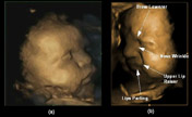 4D scans show unborn babies' facial expressions 