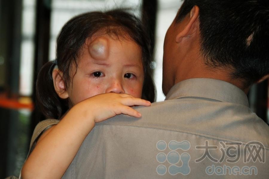 Yimin falls down by accident. She got a nasty bump on the head. Zhang sent her to the nearest hospital immediately. Since Zhang's girlfriend left him, Zhang had to send Yimin to a Kindergarten. (Photo/Dahe.cn)