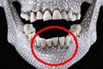 Ancient Qiang people had vertically grown teeth